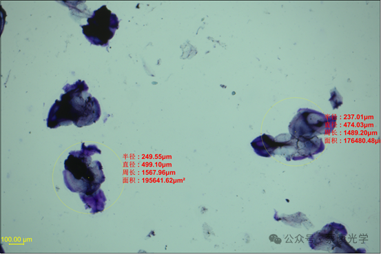 交聯(lián)透明質(zhì)酸鈉凝膠顆粒剖析內(nèi)在價值的顯微分析方案 